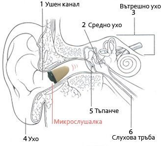 микро слушалка и трансмитер за радиостанция интегриран в портфеил